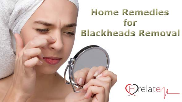 Home Remedies for Blackheads Removal