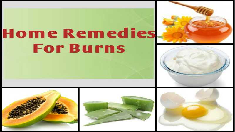 Home-Remedies-for-Burns