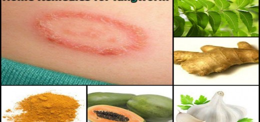 Home Remedies for Ringworm