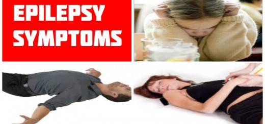 Epilepsy Symptoms