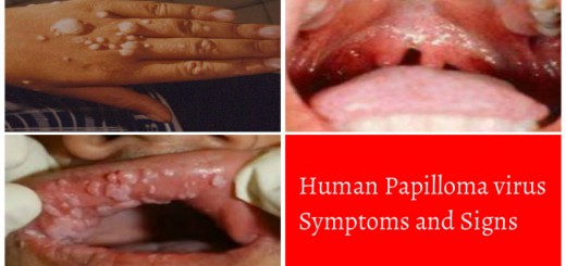 Human Papilloma virus