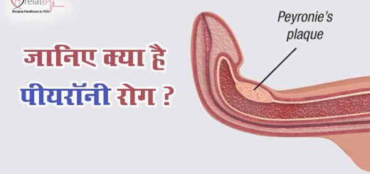 Peyronie Disease In Hindi