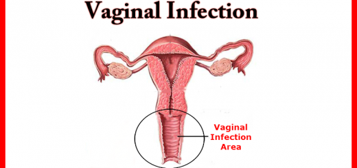 Vaginal Infection