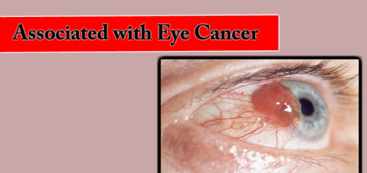 eye cancer