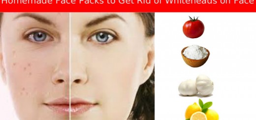 get rid of whiteheads