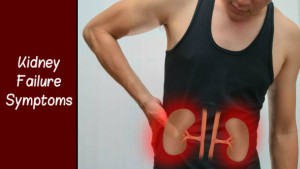 Kidney Failure Symptoms: Gurda Kharab Hone Ke Lakshan