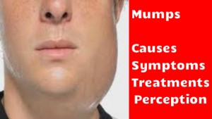 Mumps Ke Causes, Symptoms, Treatment Aur Precautions