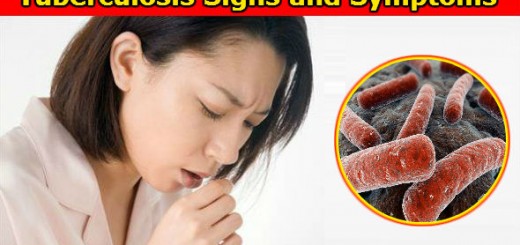 Tuberculosis Signs and Symptoms
