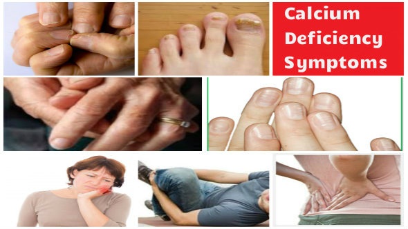 Calcium Deficiency Symptoms