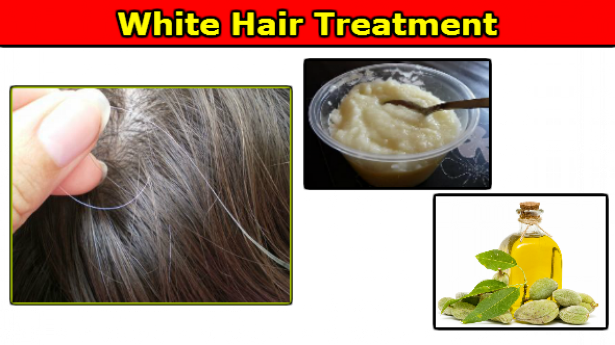 White Hair Treatment: Safed Baal ka Ilaj Hua Aasan