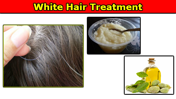 White Hair Treatment: Safed Baal ka Ilaj Hua Aasan