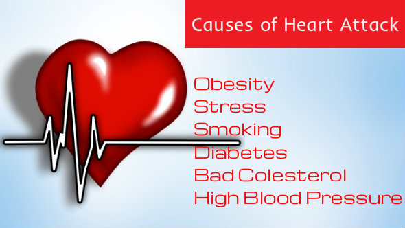 Causes of Heart Attack