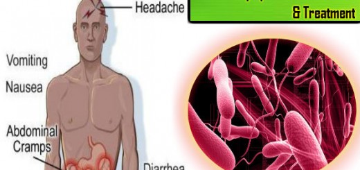 Cholera Symptoms Causes and Treatment