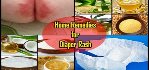 Home Remedies for Diaper Rash