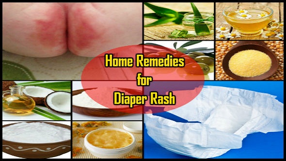 Home Remedies For Diaper Rash Aapka Baccha Rahe Swasth