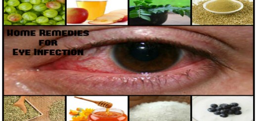 Home Remedies for Eye Infection