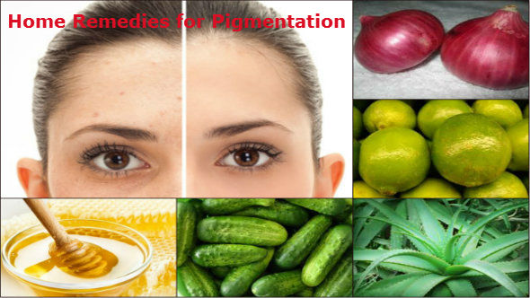 Home Remedies for Pigmentatio