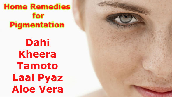Home Remedies for Pigmentation