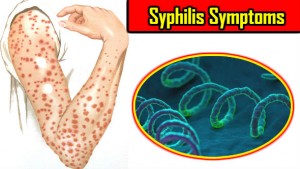 Syphilis Symptoms: Youn Sancharit Bimari ke Lakshan