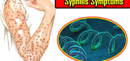 Syphilis Symptoms in Hindi