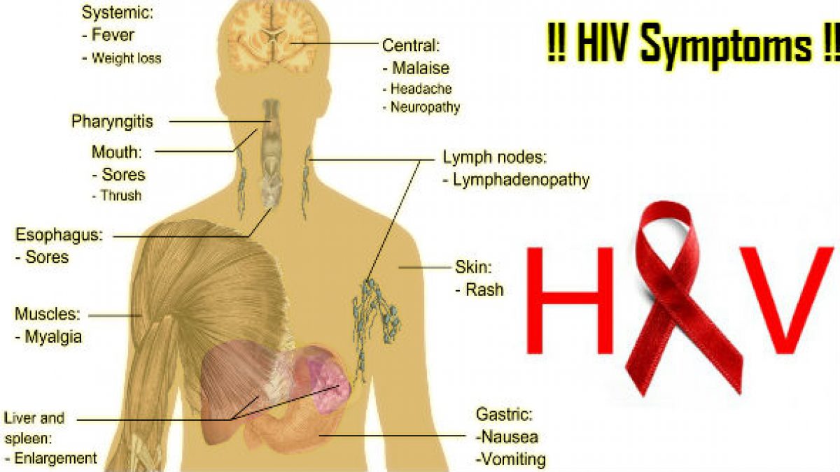 Rachenentzündung hiv 
