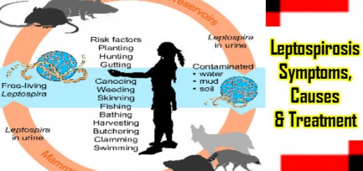 Leptospirosis Symptoms Causes and Treatment