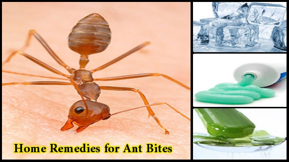 Home Remedies for Ant Bites