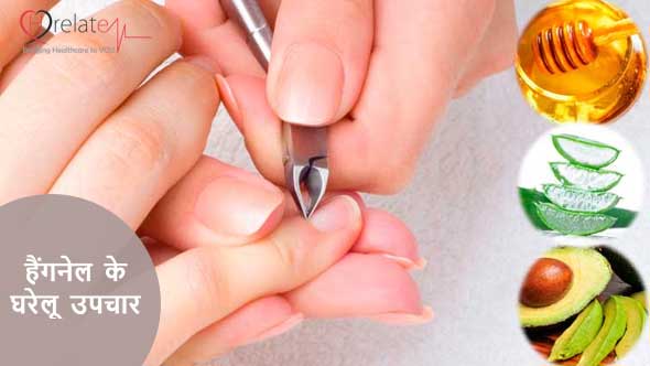 Home Remedies for Hangnails
