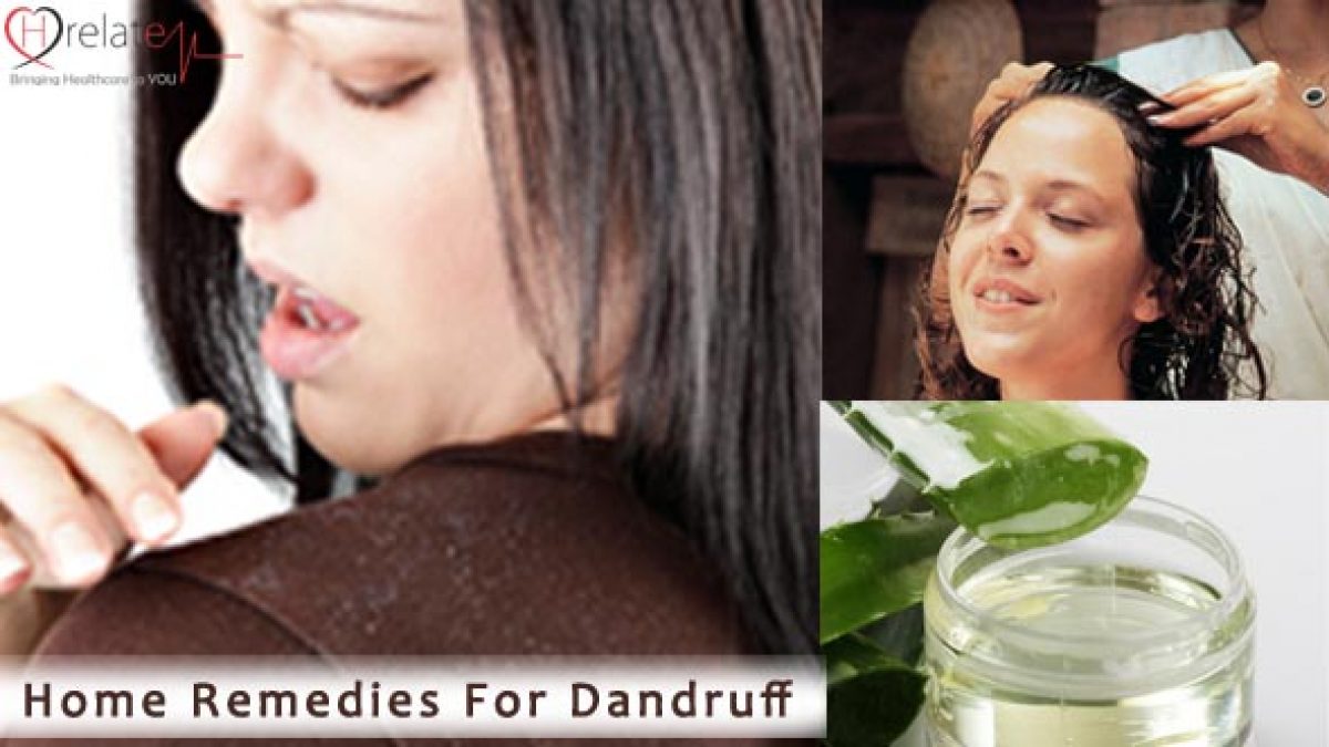 Home Remedies for Dandruff: Balo Se Rusi Kare Dur