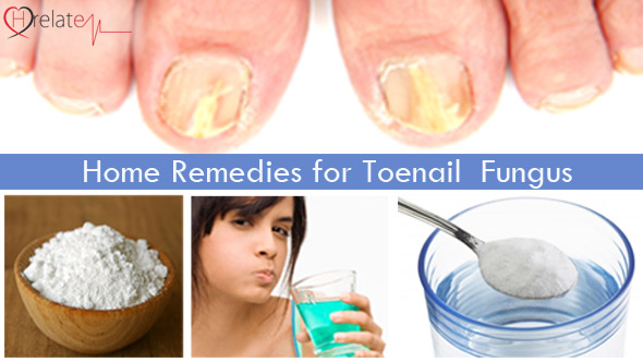 Home Remedies for toenail fungus