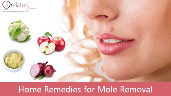 Home Remedies for Mole Removal