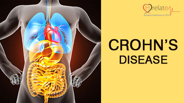Crohn’s Disease in Hindi