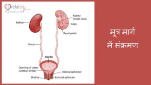 Urinary tract infection (UTI) visual data 3