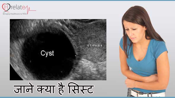 Cyst in Hindi