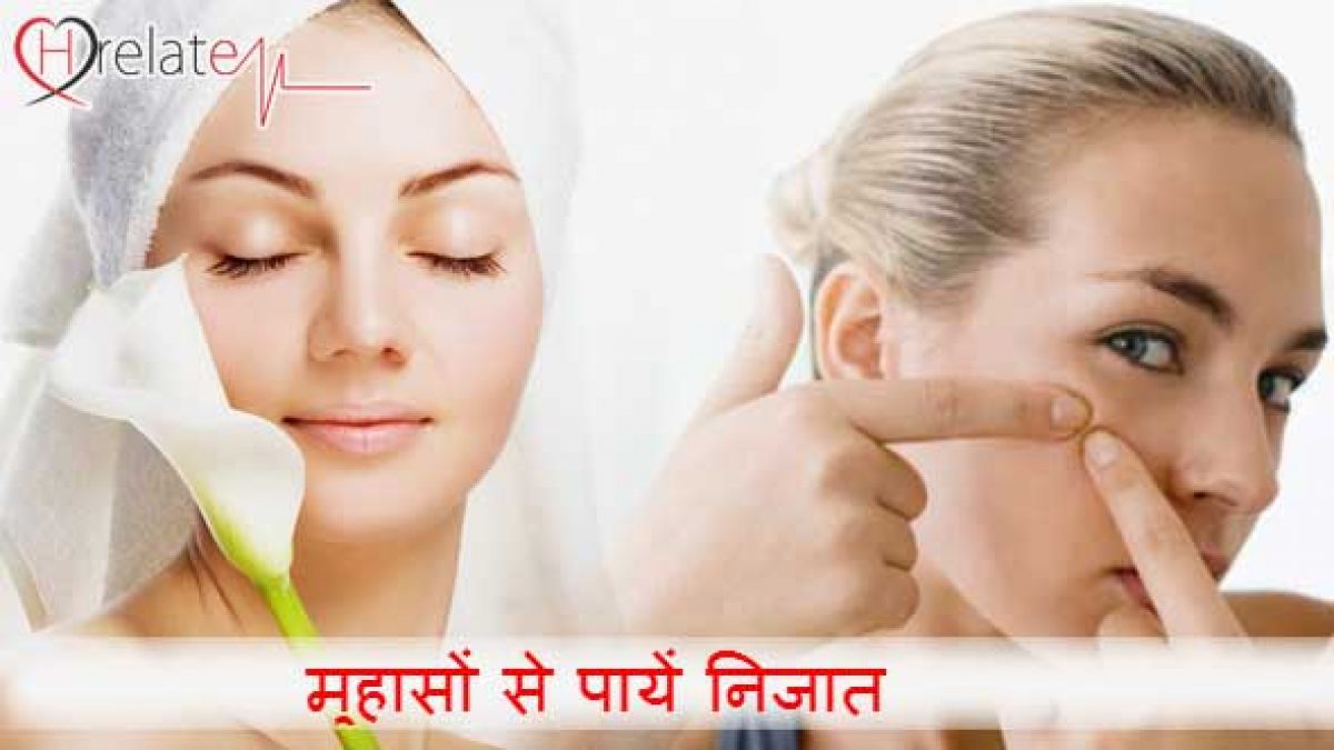 pimple ki cream
