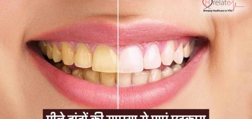 Teeth Whitening Home Remedie