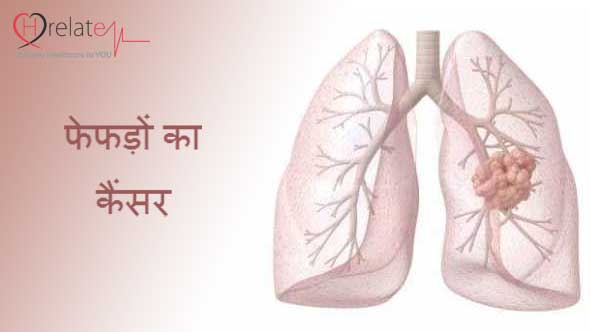Lung Cancer in Hindi