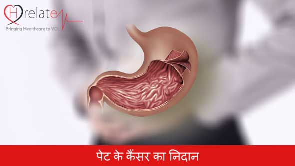 Pet Ka Cancer in Hindi