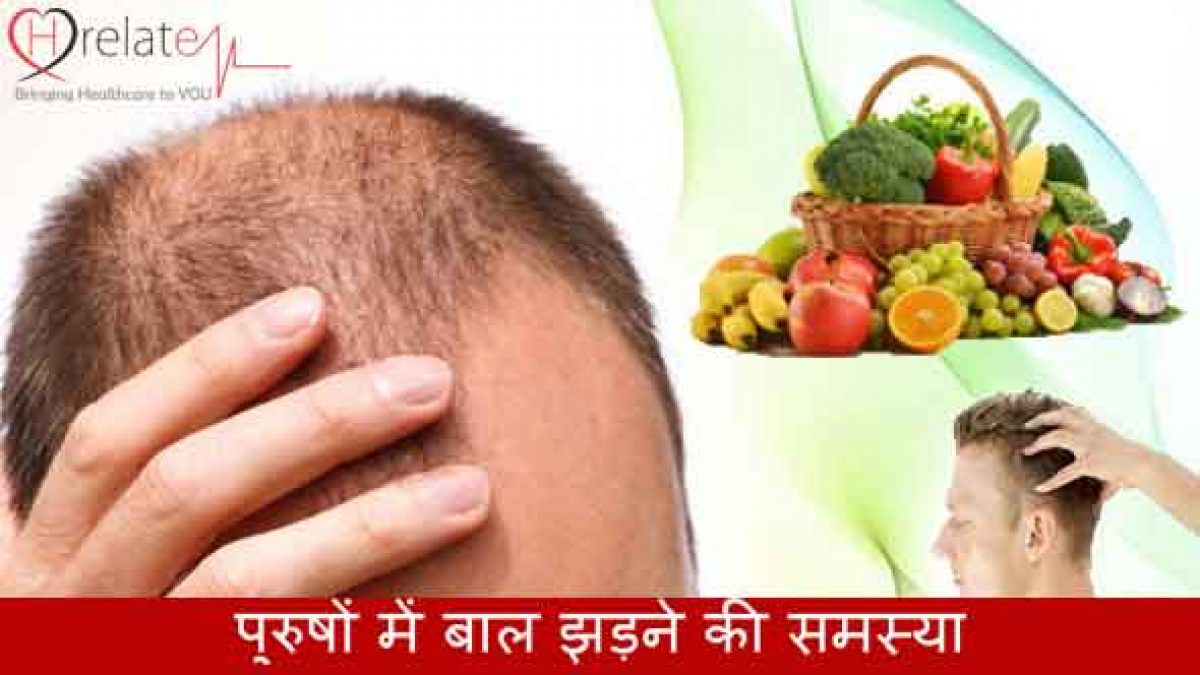 बालों का गिरना रोकिये, जानिए Hair Loss Treatment for Men in Hindi