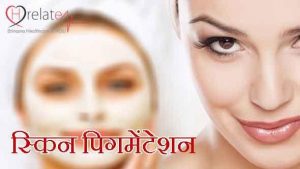 What is Pigmentation in Hindi - Twacha Ki Samanya Samasya