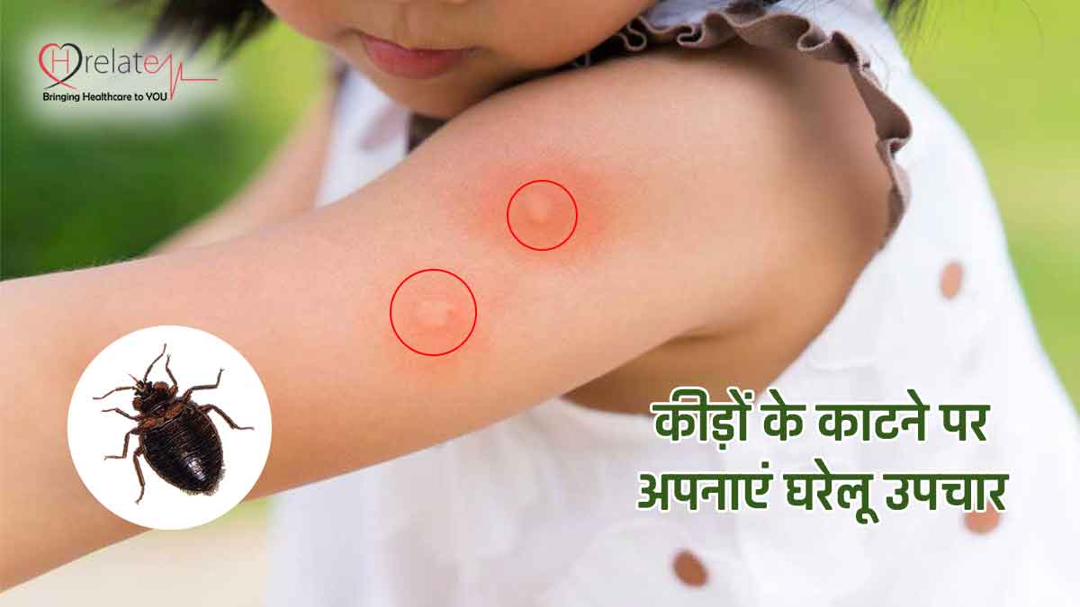 Home Remedies For Insect Bite