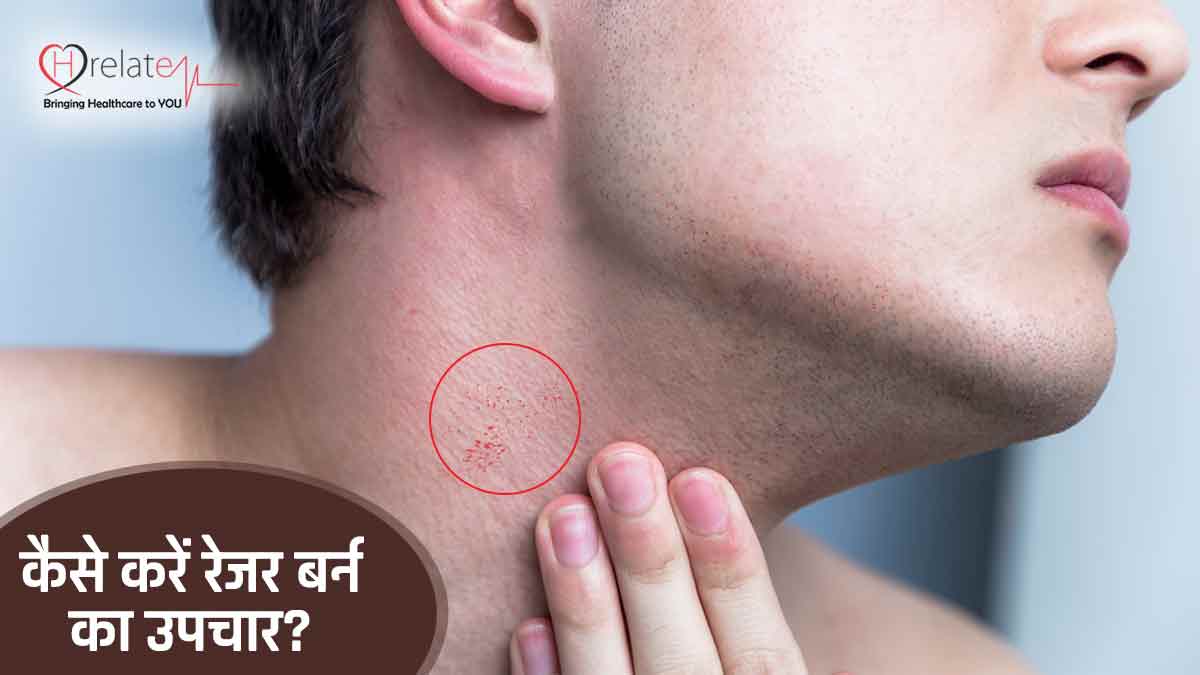 Razor Burn Treatment in Hindi