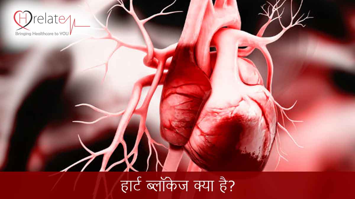 Heart Blockage Symptoms