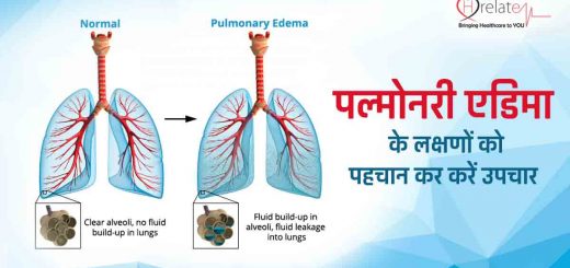 Pulmonary Edema in Hindi