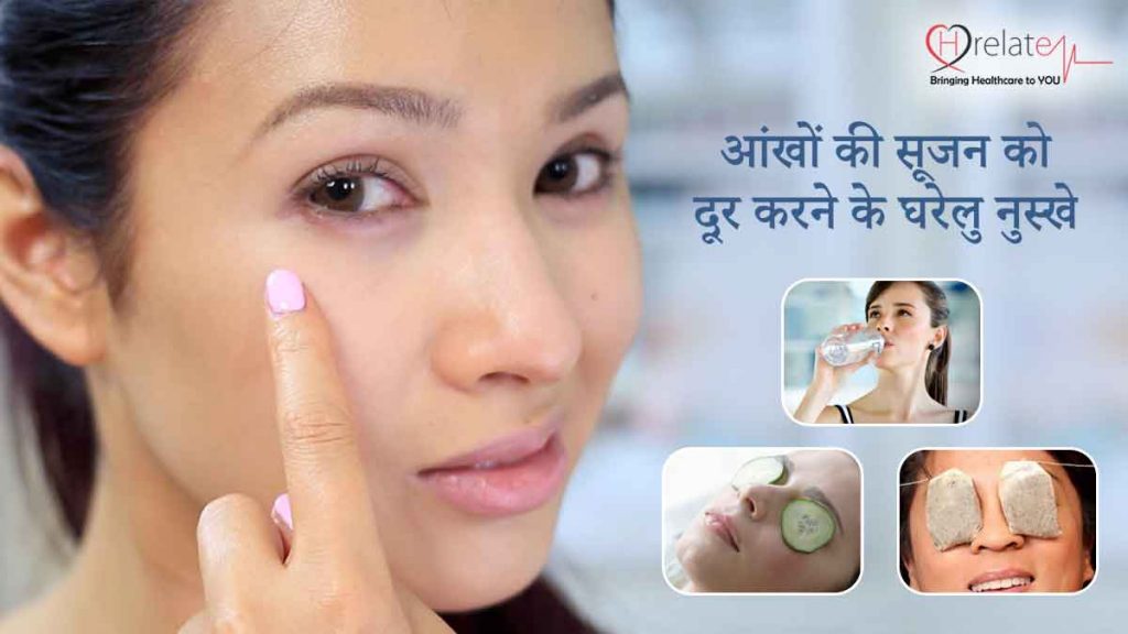 Eye Swelling Treatment In Hindi घर बैठे आँखों की सूजन करें दूर
